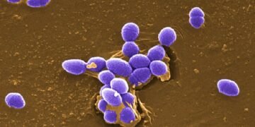 Três hospitais de Salvador registram infecções por bactéria super-resistente