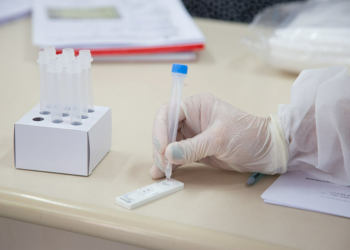 Lauro de Freitas disponibiliza testes após registrar 159 casos de covid-19