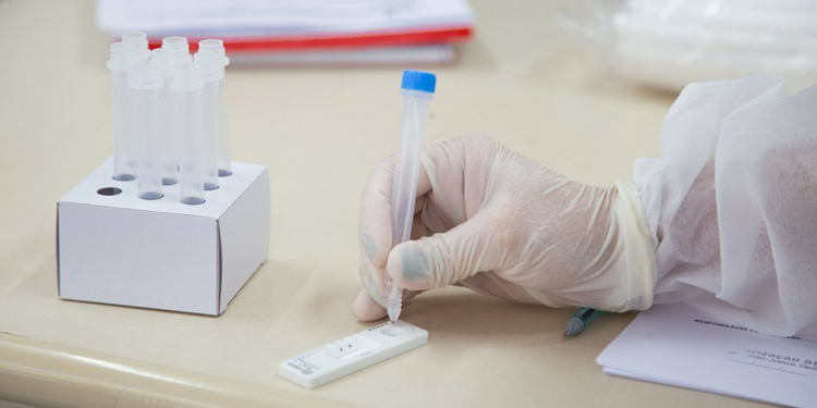 Lauro de Freitas disponibiliza testes após registrar 159 casos de covid-19