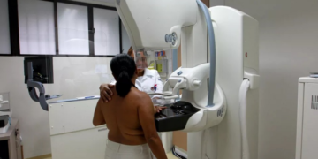 Exames de mamografia de rastreamento são ofertados na Maternidade de Camaçari