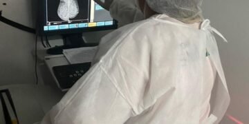 IRSI fortalece campanha do Dia Nacional da Mamografia