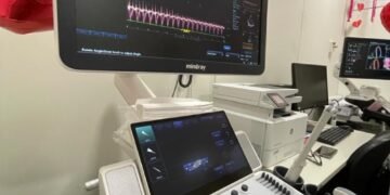 Projeto Tum Tum: maternidade Maria da Conceição comemora realização de mil exames para rastreio e tratamento de cardiopatias congênitas