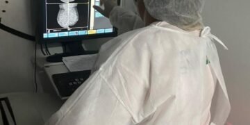 Feira de Saúde, nesta quarta, oferece mamografia, oftalmologia e  auricoloterapia