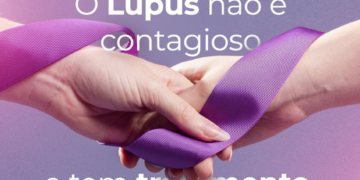 Prefeitura de Juazeiro promove Semana Municipal de Atenção à Pessoa com Lúpus