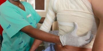 Bahia é referência no tratamento de queimados