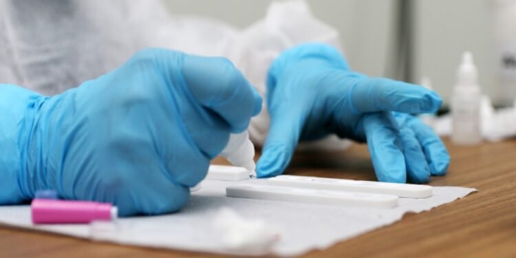 Sesab realiza quase 12 mil testes de IST e distribui 2 milhões de preservativos no período de São João