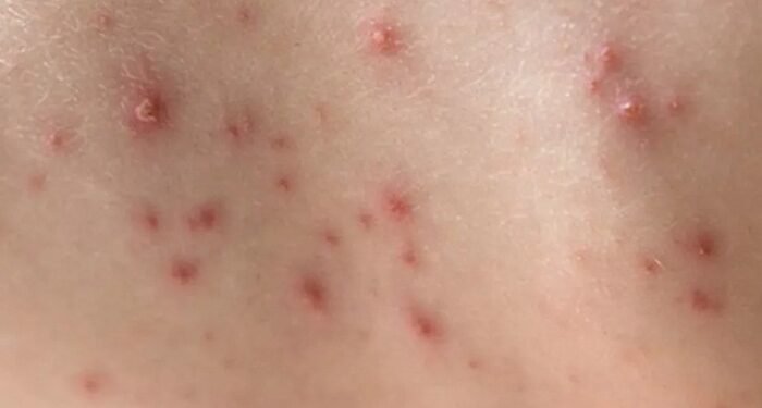 Crédito Foto: Site Rede GN