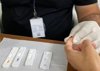 Testagem foto Leonardo Rattes SAÚDE GOVBA