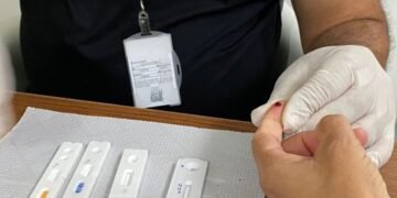 Testagem foto Leonardo Rattes SAÚDE GOVBA